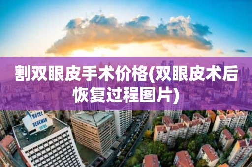 割双眼皮手术价格(双眼皮术后恢复过程图片)
